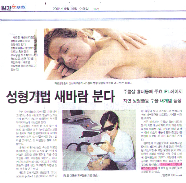 일간스포츠-성형기법.jpg