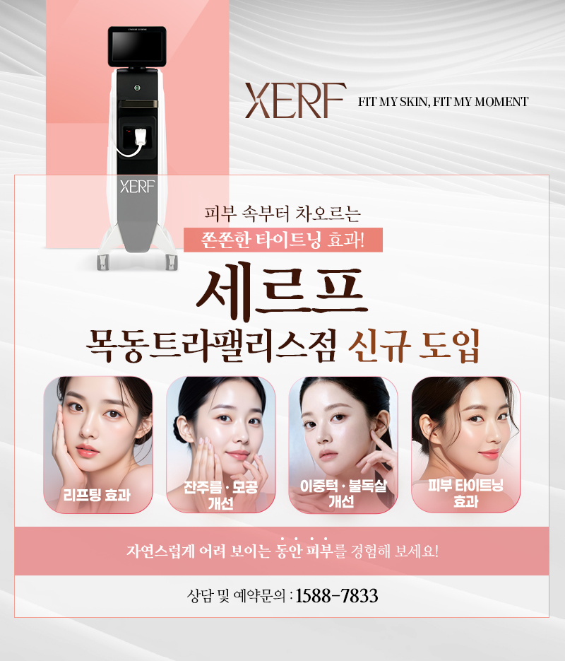 세르프 신규 도입