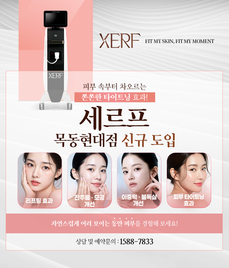 세르프 신규 도입