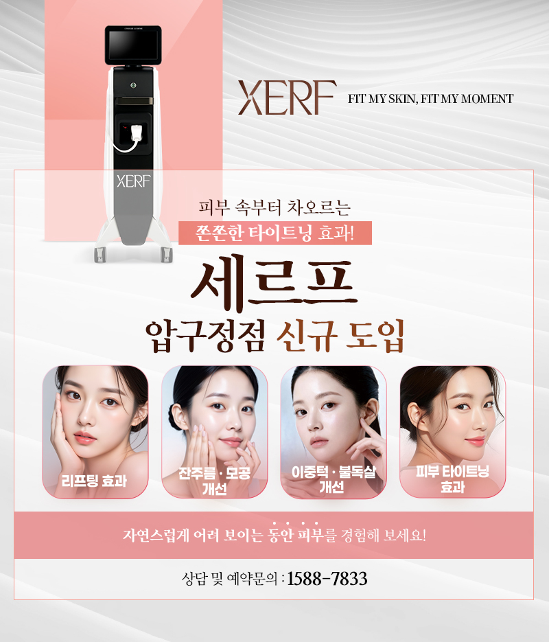 세르프 신규 도입