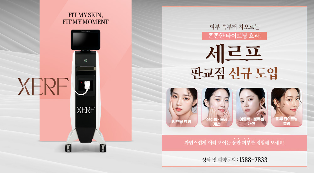 세르프 신규 도입