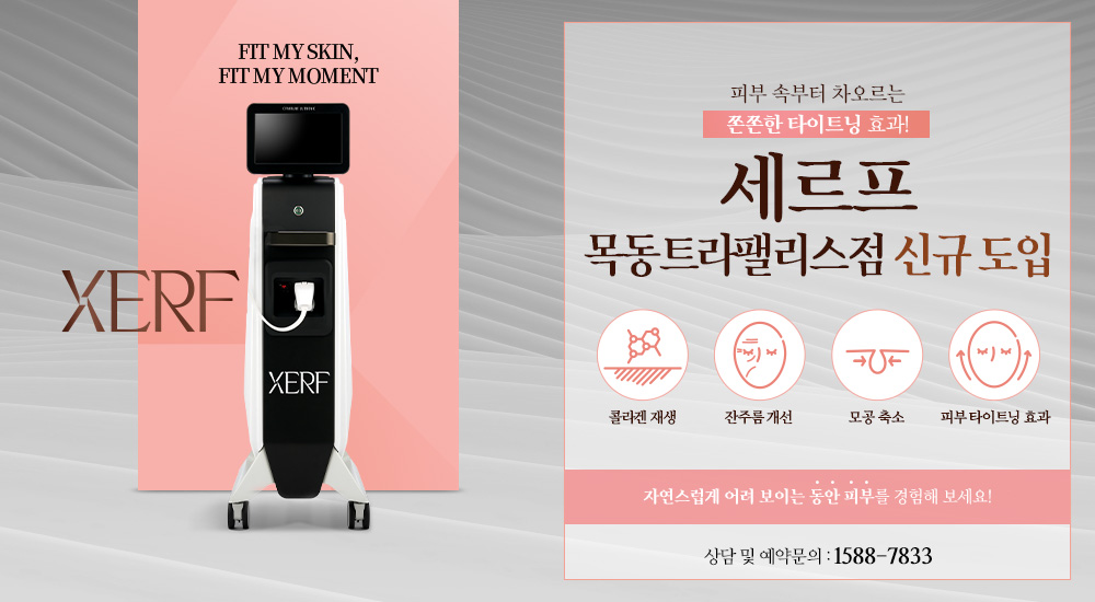 세르프 신규 도입