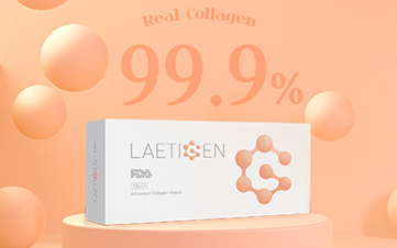 Laetigen